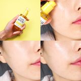  Tinh Chất Dưỡng Trắng Da Some By Mi Yuja Niacin 30 Days Blemish Care Serum 50ml 