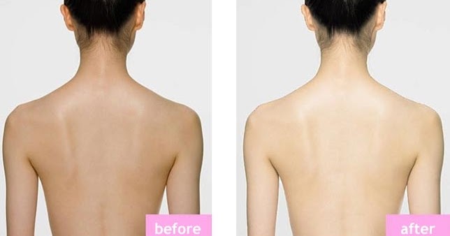 Sữa Tắm Trắng Da Toàn Thân White Conc 8- Bici Cosmetics
