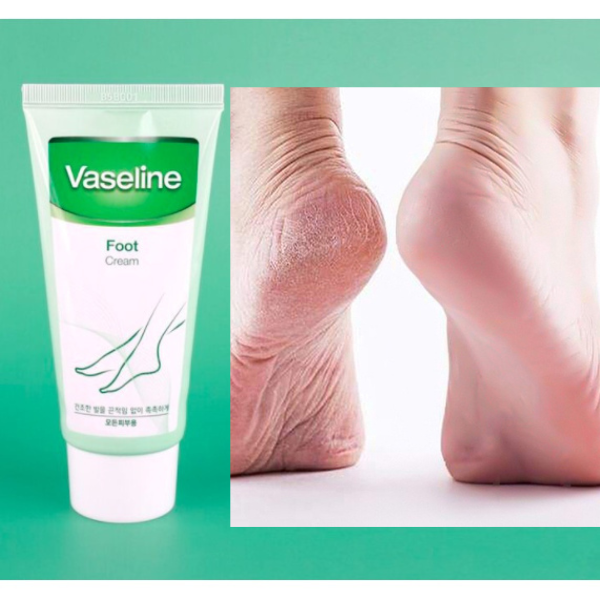 Lotion Dưỡng Da Chân Mềm Mịn Chống Nứt Nẻ VASELINE Foot Cream - Hàn Qu –  Bicicosmetics