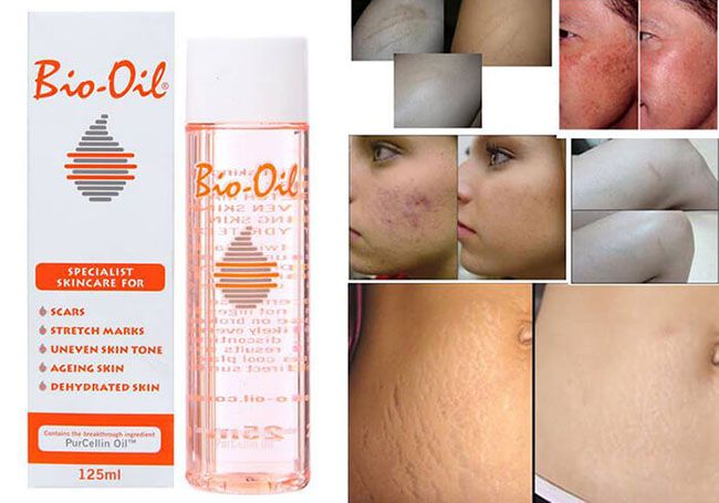  Tinh Dầu Trị Rạn Da, Mờ Sẹo BIO OIL Skincare Oil 