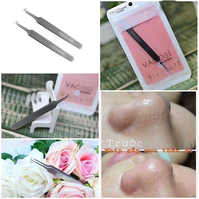 Trước và sau khi sử dụng Nhíp Gắp Mụn Thần Kỳ Vacosi Blackhead Tweezers 1