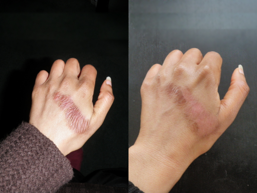 Vitamin E Kirkland Signature Vitamin E 400 I.U. 500 Viên Bicicosmetics