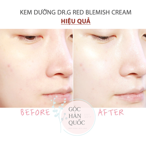  KEM DƯỠNG CHO DA DẦU MỤN LÀM DỊU DR.G RED BLEMISH CLEAR SOOTHING CREAM 