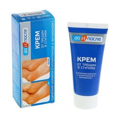 kem nứt nẻ gót Kpem 50ml