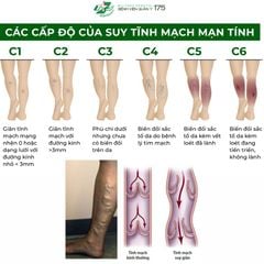 Máy nén ép trị liệu suy giãn tĩnh mạch chân Kachi MK394