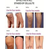 Kem Định Hình Giảm Béo Vòng Eo 30G Nội Địa Trung Mẫu NDT264