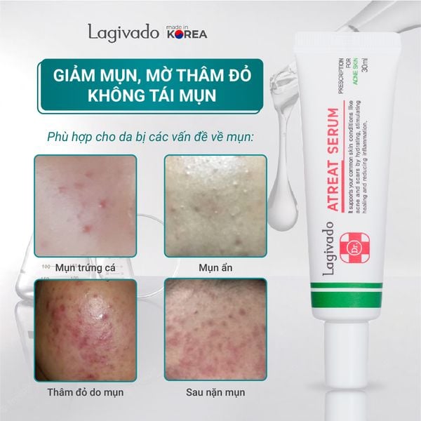 Tinh chất serum giảm mụn, mờ thâm, ngừa sẹo rỗ Hàn Quốc Lagivado Dr. ATreat Serum 30 ml