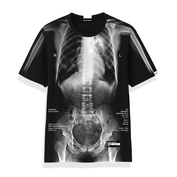  X-Ray Skeleton All-Over-Print Tee 