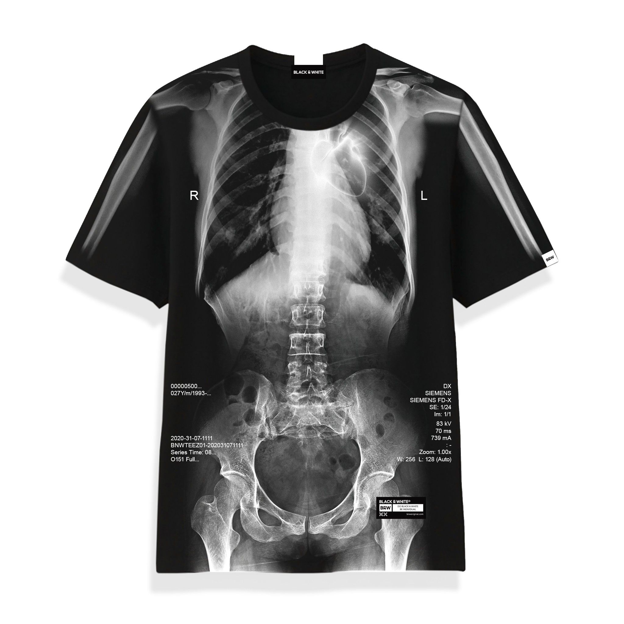  X-Ray Skeleton All-Over-Print Tee 