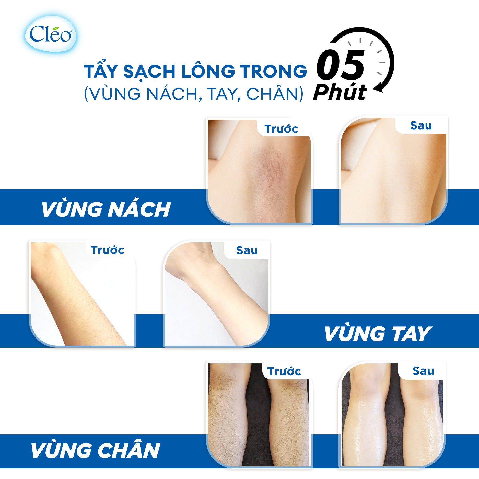  Kem Tẩy Lông Đa Vùng Hương Nước Hoa Cleo 70g Cao Cấp 