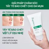  Gel Tẩy Tế Bào Chết Vật Lý, Nhẹ Nhàng Làm Sáng Da, Dưỡng Ẩm Easydew Ex Clean Control Bright Peeling Gel 120ml 