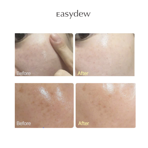 Kem Hỗ Trợ Làm Mờ Vết Nhăn, Ngăn Lão Hóa, Làm Mới Da DW-EGF RETINOL 0.3% MELATONING CREAM 1ml (Expert) 