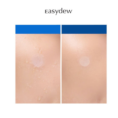  Miếng Dán Mụn Kim Tinh Chất Vi Mô Easydew ACNE CLEAR NEEDLE PATCH (4 miếng) 