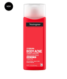  Sữa Tắm Tẩy Tế Bào Chết và Trị Mụn Neutrogena Stubborn Body Acne Cleanser & Exfoliator 