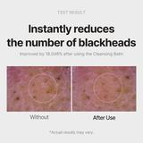  Sáp tẩy trang Carrotene IPMP™ Hydromelt cleansing balm 90ml 