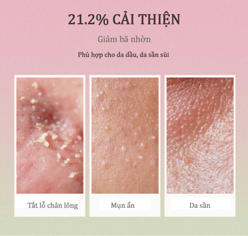 Set Pink Aloe (Kem rửa mặt Aloe+ Toner Aloe) 