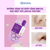  Mặt Nạ Tẩy Tế Bào Chết The H.P.A Glowing Ampoule Mask Mediheal 25Ml 
