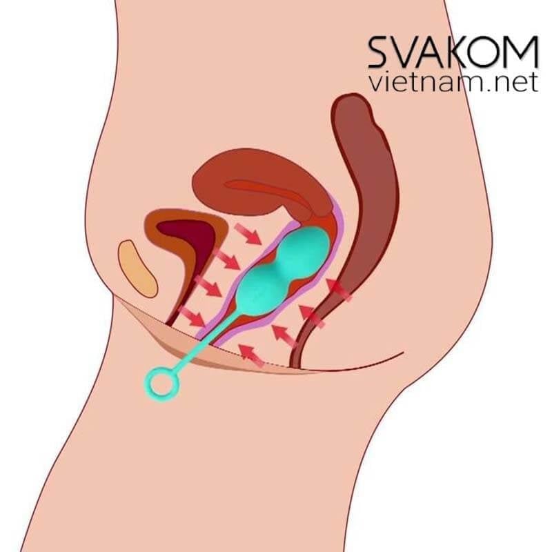  Bóng tập Kegel SVAKOM Nova Plus Bài tập Kegel cho nữ se khít âm đạo 
