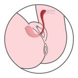  SVAKOM Phoenix Neo 2 trứng rung điểu khiển từ xa và đồng bộ video người lớn 