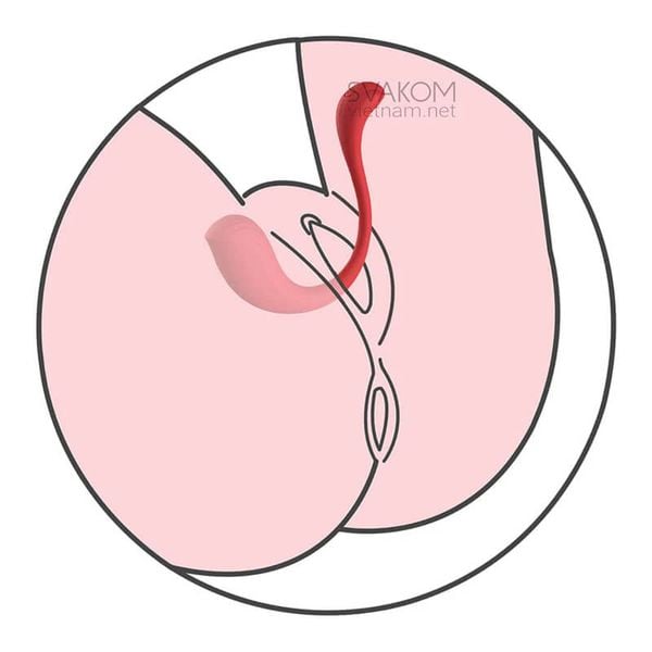 trứng rung SVAKOM Phoenix Neo 2