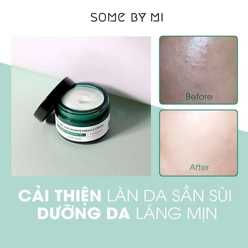 Kem Dưỡng Trị Mụn Some By Mi AHA-BHA-PHA 30 Days Miracle Cream