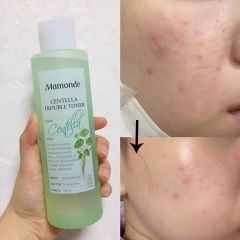 Nước Hoa Hồng Rau Má Centella Mamode Trouble 150ml