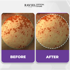 Kem đặc trị lão hóa, giảm nếp nhăn RAVIEL Bakuchiol Mela Free Cream Brightening Skin Elasticity 50ml