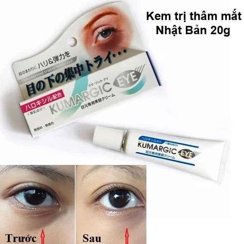 Kem Cải Thiện Thâm Quầng Mắt Kumargic Eye Của Nhật