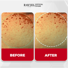 Kem dưỡng trắng trị thâm nám và tái tạo da RAVIEL Acerola Dark Spot & Blemish Care Cream 50ml