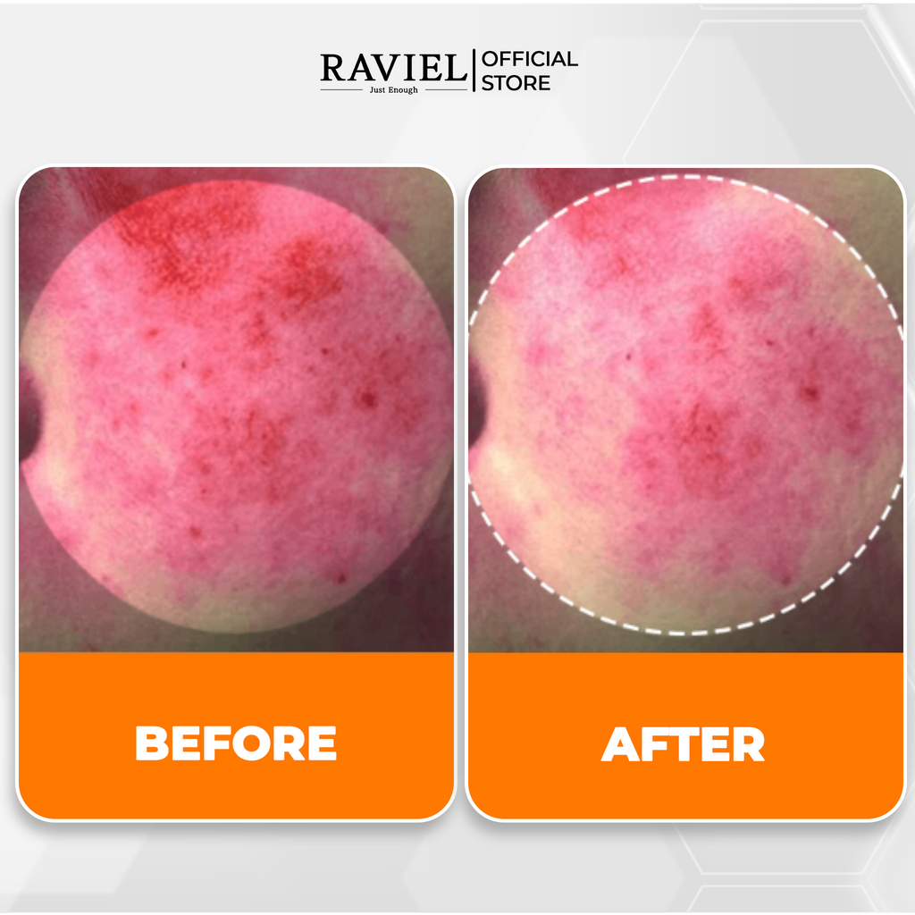 Tinh chất dưỡng sáng, căng bóng da RAVIEL Multi Vitamin Blemish & Dark Spot Care Serum Hydration Boosting 50ml