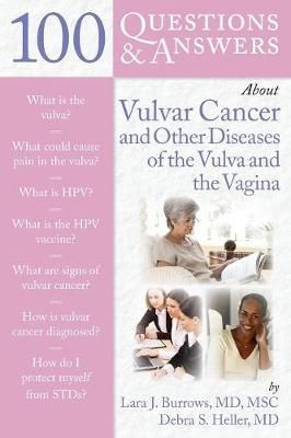 100 Questions and Answers About Vulvar Cancer and Other Diseases of the Vulva and Vagina