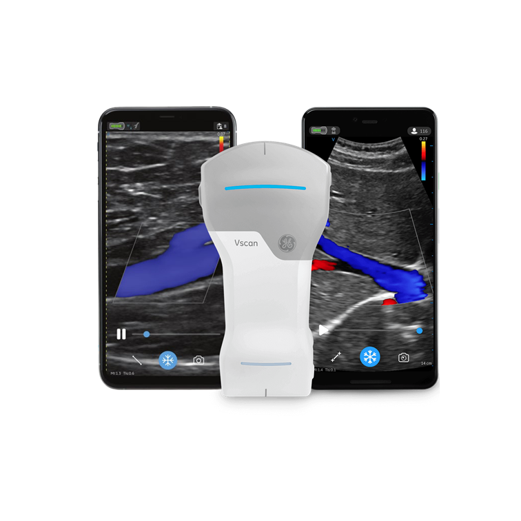  Máy siêu âm chẩn đoán Vscan Air CL 