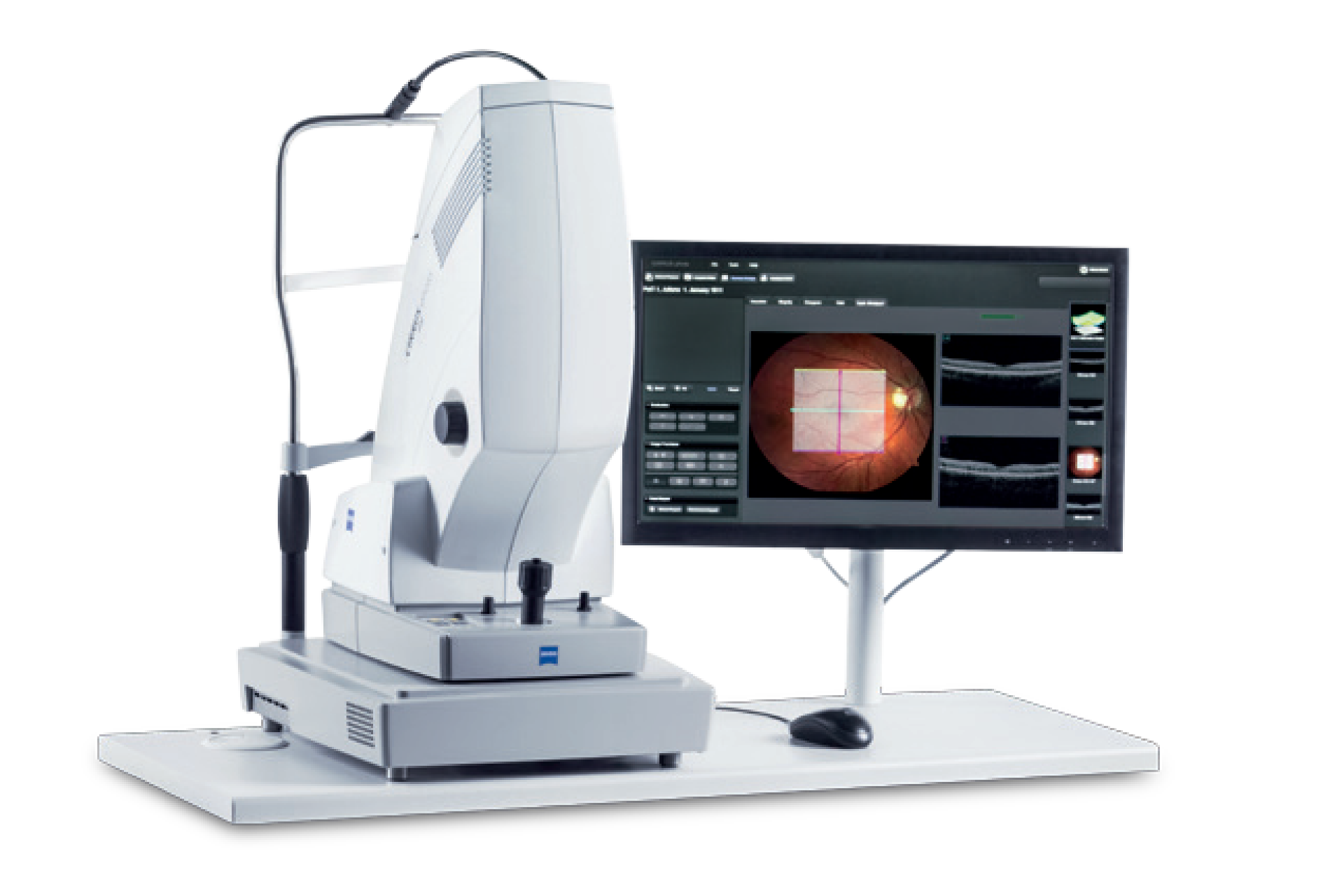  ZEISS CIRRUS™ photo 