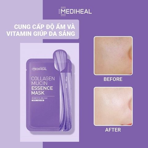  Mặt Nạ Cải Thiện Nếp Nhăn Mediheal Collagen Mask 20ml 