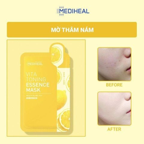  Mặt Nạ Vita Essence Làm Trắng Da, Mờ Thâm Mediheal Vita Toning Essence Mask 20ml 