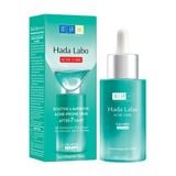  Serum dưỡng ẩm cho da mụn, nhạy cảm HADA LABO ACNE CARE CALMING SERUM 30ml 