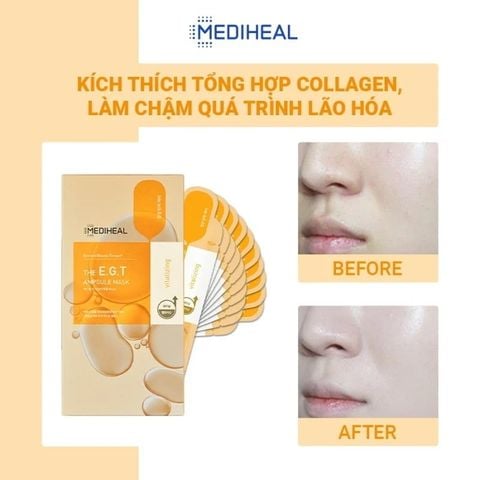  Mặt Nạ E.G.T Nuôi Dưỡng, Săn Chắc Làn Da Mediheal The E.G.T Nourishing Ampoule Mask 27ml 