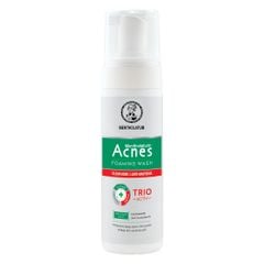 Dung Dịch Tạo Bọt Ngăn Ngừa Mụn Acnes 150ml 