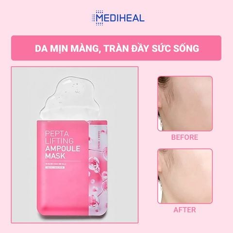  Mặt Nạ Nâng Cơ, Trẻ Hoá Da Mediheal Pepta Lifting Pepta Lifting Ampoule Mask 20ml 