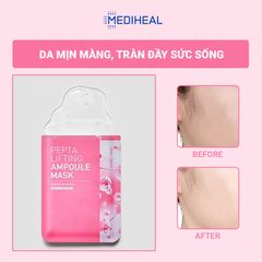  Mặt Nạ Nâng Cơ, Trẻ Hoá Da Mediheal Pepta Lifting Pepta Lifting Ampoule Mask 20ml 