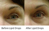  Lipid Drops 