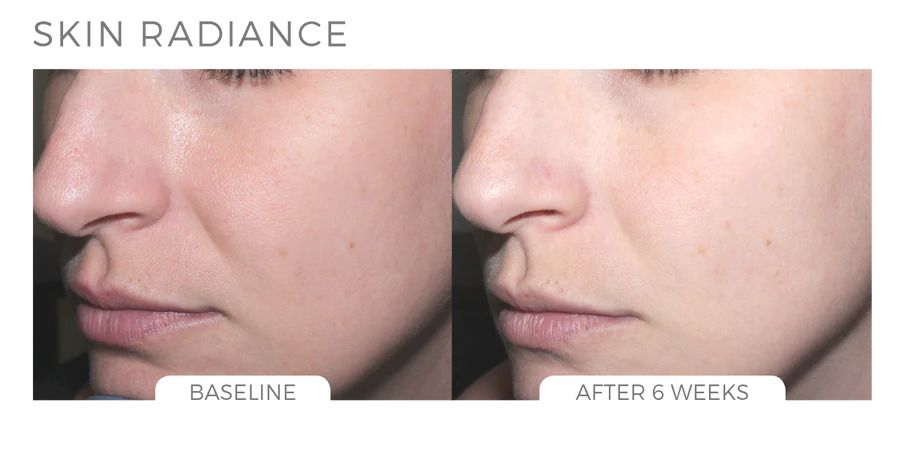  Skin brightening system 