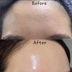 (12/2025) Serum phục hồi da K Lady Care Bakuchiol Retinol Serum 50ml