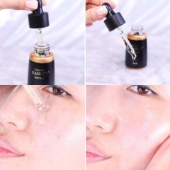 (08/2025) Tinh Chất Trị Nám Tàn Nhang Dongsung Rannce Serum 45ml
