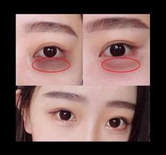 (04/2025) Kem mắt JM Solution Xanh 40ml