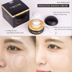 Kem Nám Dongsung Rannce Cream mini 10g