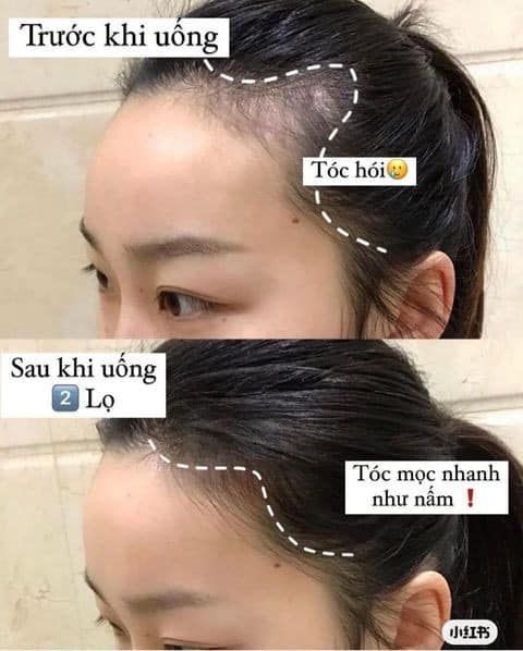 (02/2026) Viên uống BIOTIN 10,000mg Puritan Pride 50v