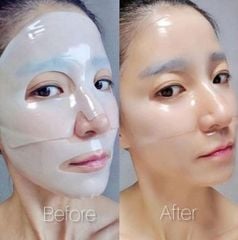 (03/2026) Mặt nạ thạch Medianswer Vita Collagen Mask 5 miếng