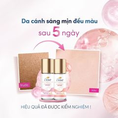 (09/2025) Serum lăn nách Dove Deodorant Dry