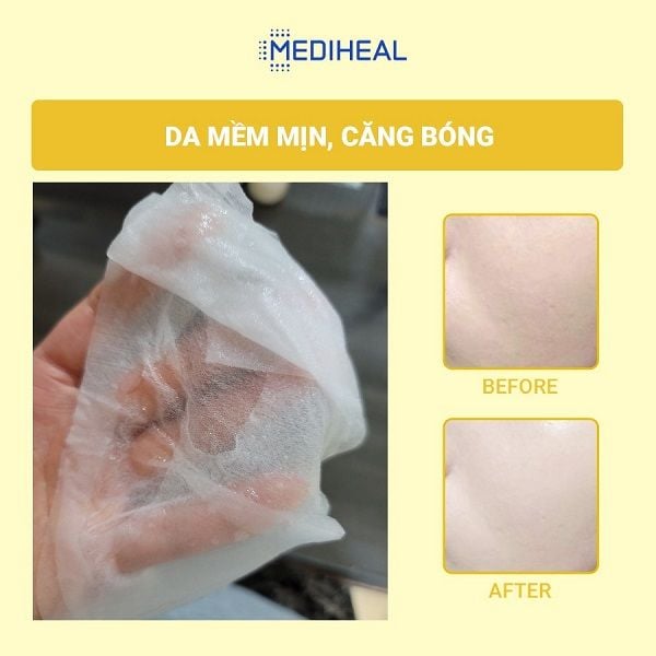 Mặt Nạ Mediheal Ampoule/Essence/Water Mask 20ml